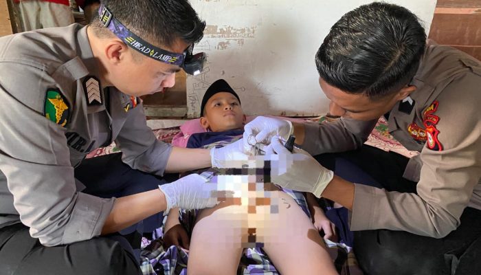 Ini Program Polisi Sunat Personi Biddokkes Polda Sulsel, Masyarakat : Kami Sangat Bersyukur Adanya Progam ini