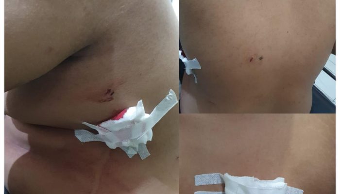 Kurang Dari 12 Jam, Pelaku Penganiayaan Berhasil Diamankan Sat Resmob Polres Sidrap